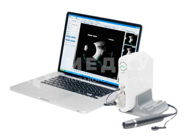 Ультразвуковой офтальмологический A/B сканер Suoer SW-2100 medcub