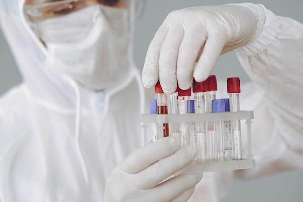 Комплексный обзор коагулометров: принцип работы, виды и области применения medcub