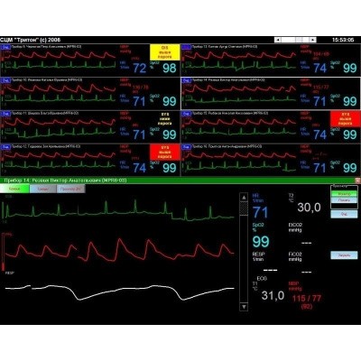 Станция мониторная центральная Treaton СЦМ2.24 medcub