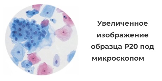 Увеличенное изображение образца Р20 под микроскопом