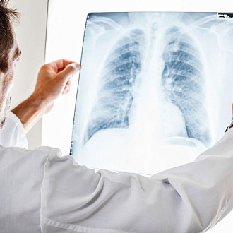 Приказ 560н «Об утверждении Правил проведения рентгенологических исследований» medcub