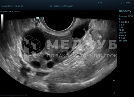 Аппарат УЗИ (сканер) Mindray Resona 7s medcub
