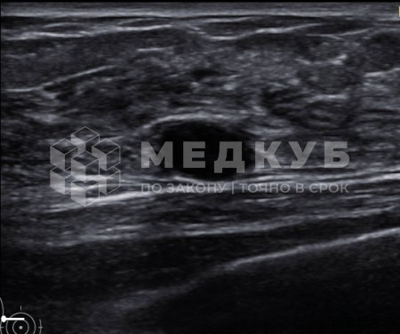 УЗИ-аппарат портативный НПО Сканер РуСкан 70П medcub