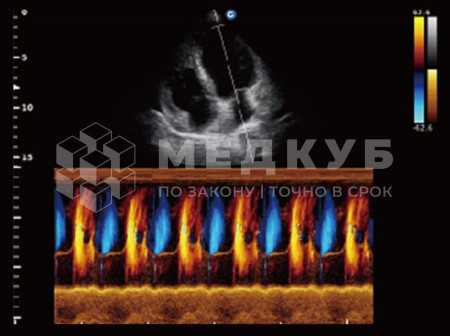 Аппарат УЗИ (сканер) Chison QBit 5 medcub