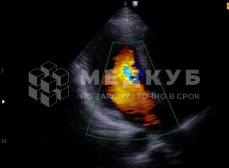 УЗИ-аппарат портативный НПО Сканер РуСкан 70П medcub