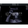 Аппарат УЗИ (сканер) GE Healthcare Voluson P8 medcub