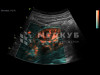 Аппарат УЗИ (сканер) GE Healthcare Vivid S70N medcub