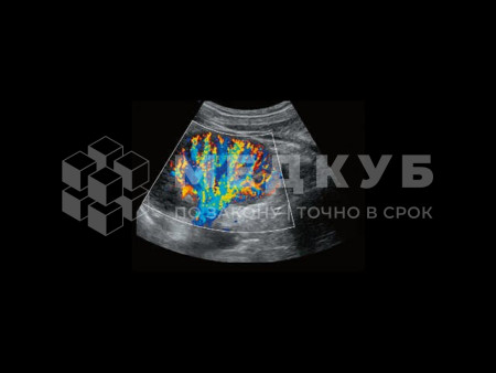 Аппарат УЗИ (сканер) Chison Qbit 12 medcub