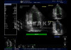 Аппарат УЗИ (сканер) GE Healthcare Vivid T8 medcub