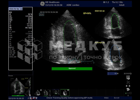 Аппарат УЗИ (сканер) GE Healthcare Vivid T8 medcub