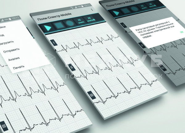 Электрокардиограф (ЭКГ) 12-канальный Нейрософт Поли-Спектр-8/ЕХ беспроводной medcub