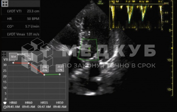 Аппарат УЗИ (сканер) GE Healthcare VENUE R2.5 medcub
