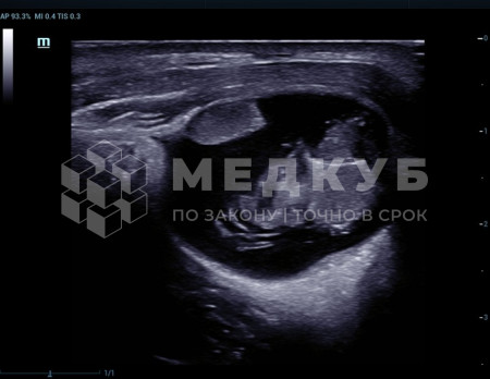 Аппарат УЗИ (сканер) Mindray Resona 6 medcub