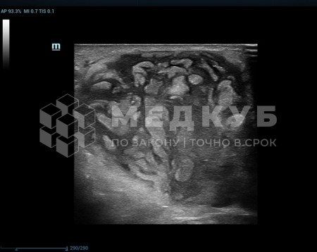Аппарат УЗИ (сканер) Mindray Resona 7s medcub