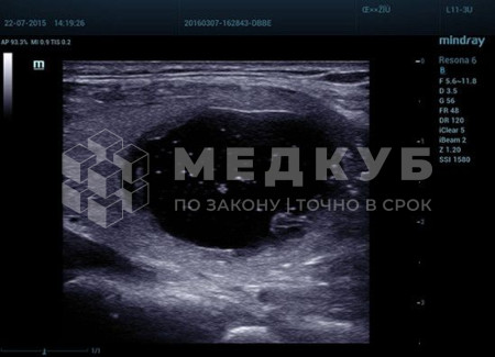 Аппарат УЗИ (сканер) Mindray Resona 6 medcub