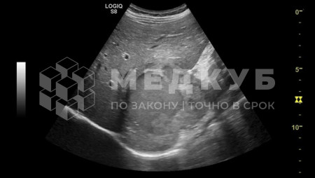 Аппарат УЗИ (сканер) GE Healthcare Logiq S8 medcub