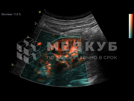 Аппарат УЗИ (сканер) GE Healthcare Vivid S70N medcub