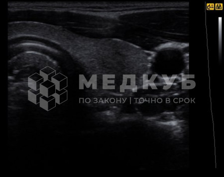 УЗИ-аппарат портативный НПО Сканер РуСкан 70П medcub