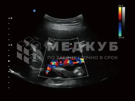 Аппарат УЗИ (сканер) Chison Qbit 3 medcub