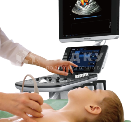 Аппарат УЗИ (сканер) Chison Qbit 11 medcub