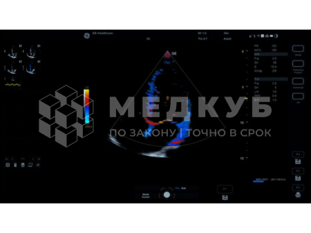 Аппарат УЗИ (сканер) GE Healthcare Versana Essential medcub