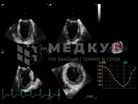 Аппарат УЗИ (сканер) GE Healthcare Vivid S70N medcub