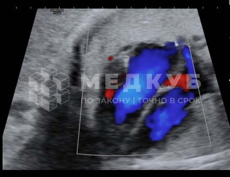 Аппарат УЗИ НПО Сканер РуСкан 65М medcub