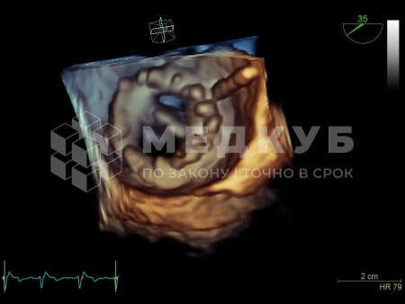 Аппарат УЗИ (сканер) GE Healthcare Vivid S70N medcub