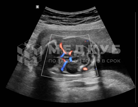 Аппарат УЗИ НПО Сканер РуСкан 65М medcub