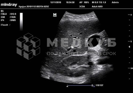Портативный аппарат УЗИ Mindray TE7 (планшет) medcub