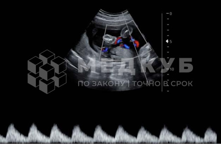 Аппарат УЗИ НПО Сканер РуСкан 65 medcub