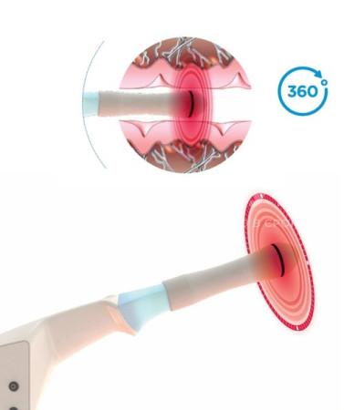 Аппарат RF-лифтинга BTL EXILIS Ultra 360 medcub