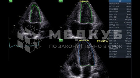 Аппарат УЗИ (сканер) GE Healthcare Vivid T8 medcub