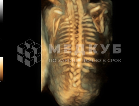 Аппарат УЗИ (сканер) Mindray Resona 7s medcub