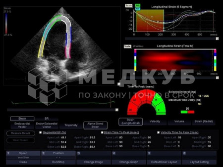 Аппарат УЗИ НПО Сканер РуСкан 50 medcub