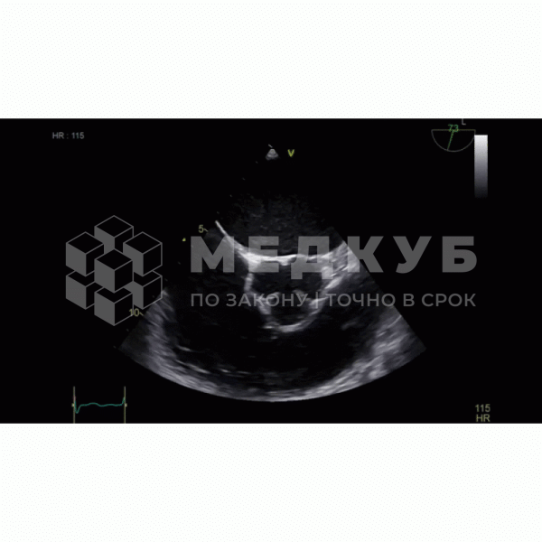 Аппарат УЗИ (сканер) GE Healthcare Vivid iq Value console medcub
