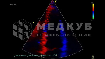 Аппарат УЗИ (сканер) GE Healthcare Vivid T8 medcub