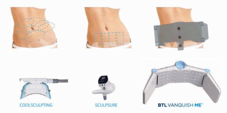 Аппарат RF-лифтинга BTL VANQUISH ME для бесконтактной коррекции фигуры и неинвазивной липосакции medcub