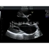 Аппарат УЗИ (сканер) GE Healthcare Voluson P8 medcub