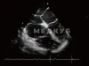 Аппарат УЗИ (сканер) Chison SonoTouch 80 Expert medcub