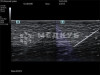 Портативный аппарат УЗИ Mindray TE7 (планшет) medcub