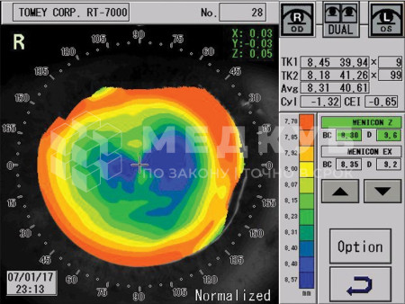 Автоматический рефрактометр Tomey RT-7000 medcub
