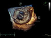 Аппарат УЗИ (сканер) GE Healthcare Vivid S70N medcub