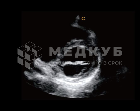 Аппарат УЗИ (сканер) Chison Qbit 8 medcub