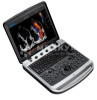 Аппарат УЗИ (сканер) Chison SonoTouch 80 Expert medcub
