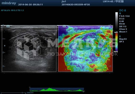 Аппарат УЗИ (сканер) Mindray Resona 7 medcub