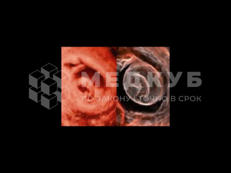 Аппарат УЗИ (сканер) Chison Qbit 12 medcub