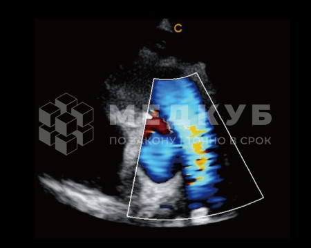 Аппарат УЗИ (сканер) Chison QBit 7 medcub