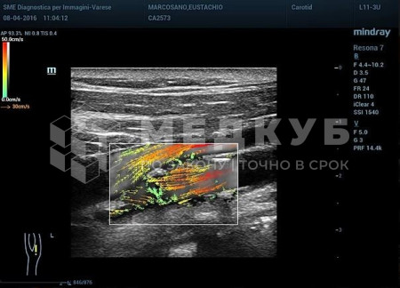 Аппарат УЗИ (сканер) Mindray Resona 7s medcub