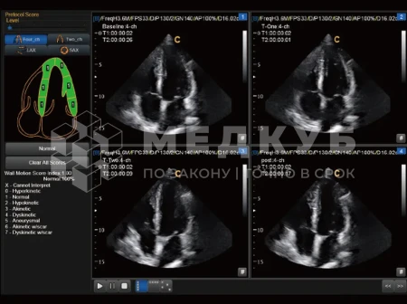 Аппарат УЗИ (сканер) Chison SonoTouch 80 Expert medcub
